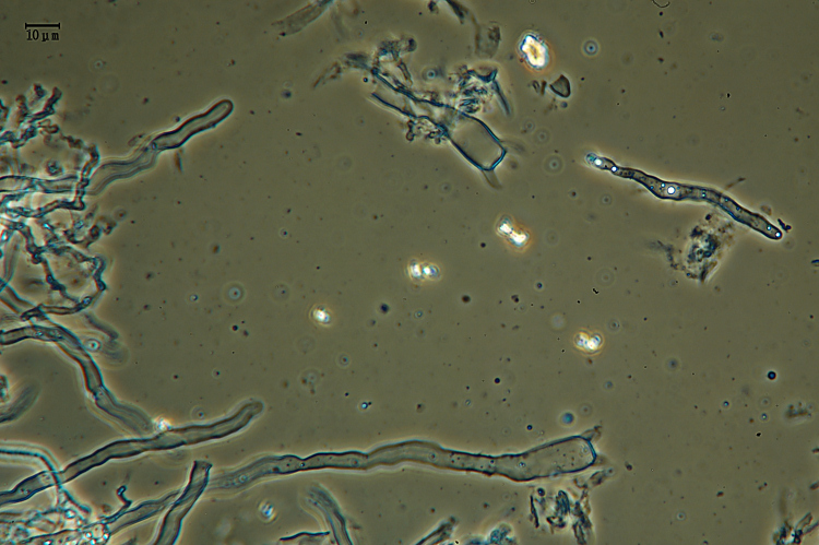 Vuilleminia 2 (Vuilleminia comedens)
